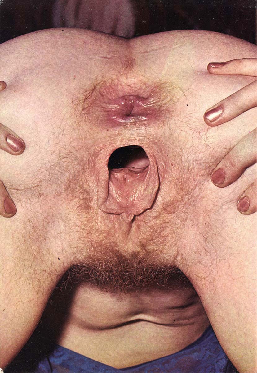 Необычные половые органы